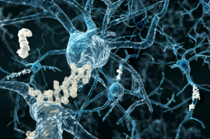 Cleveland Clinic lanza el primer estudio cerebral dirigido a diagnosticar y prevenir enfermedades neurológicas
