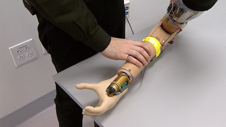 Cleveland Clinic innova con el brazo biónico para atender a pacientes